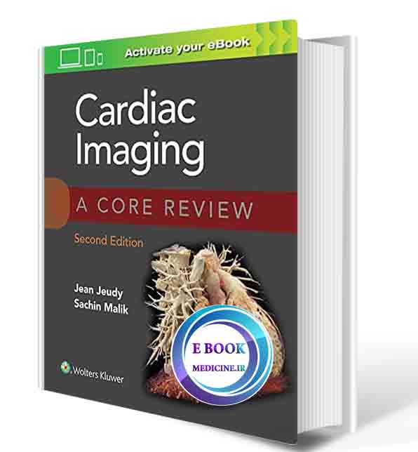 دانلود کتاب Cardiac Imaging: A Core Review Second Edition 2021 ( PDF)